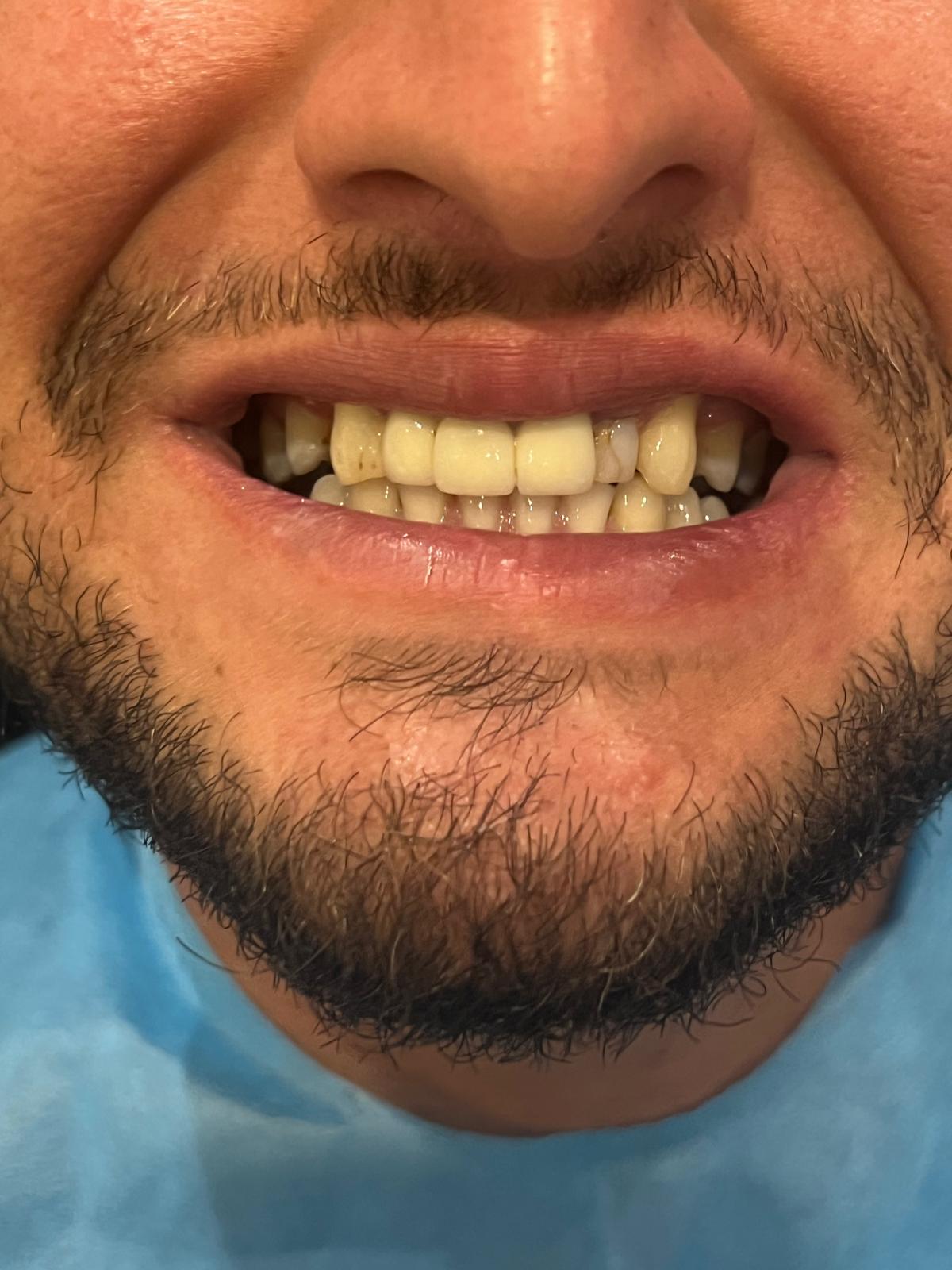 ECE Dental Patient Result
